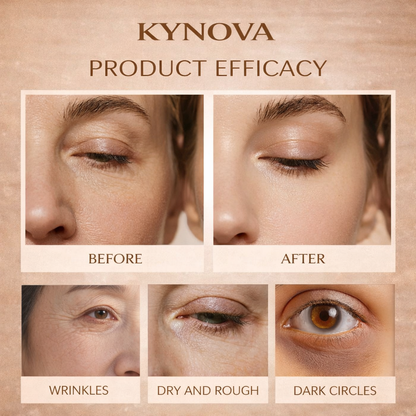 KYNOVA™ Collagen Eye Renewal Mask