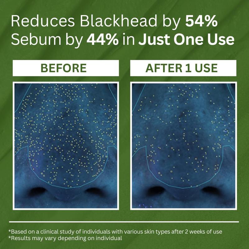 BasilGlow Sparkling Bubble Mask